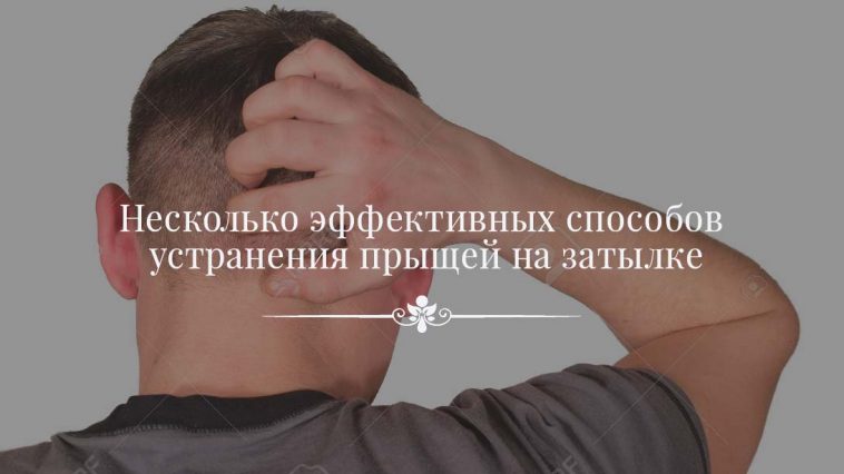 Как убрать прыщи на затылке и голове: подробная инструкция