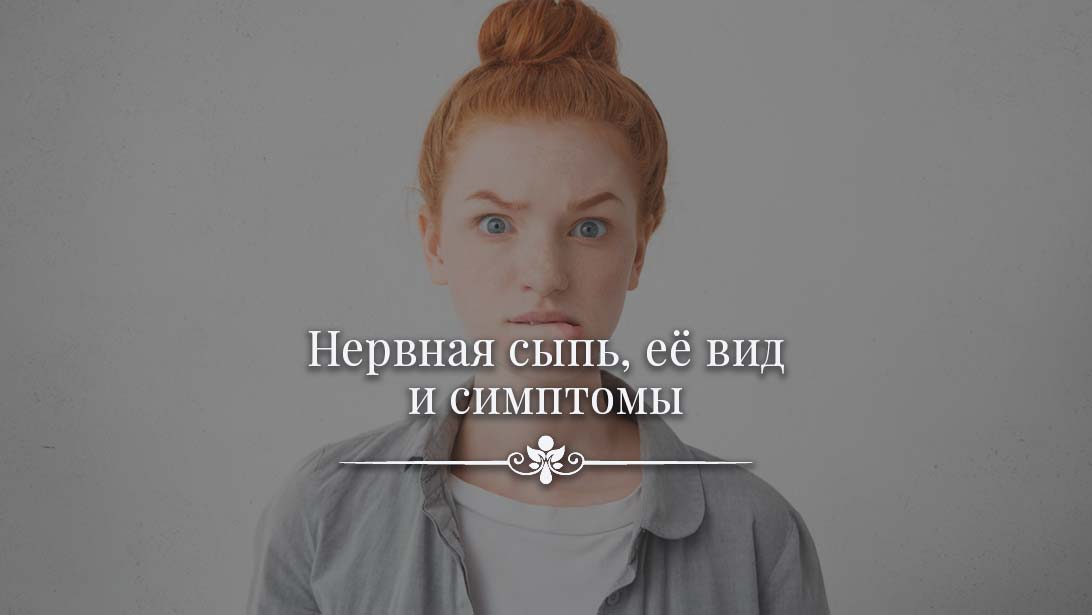 На нервной почве. Симптомы сыпь на нервной почве. Типы высыпания на нервной почве.